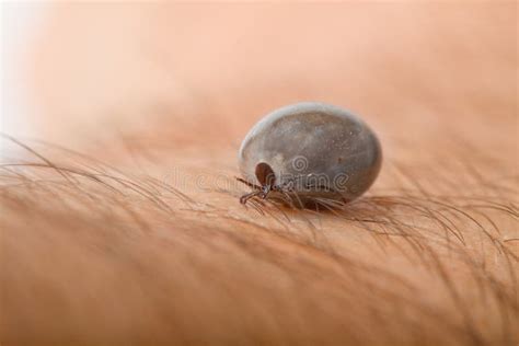 Detail Tick - Parasite on Leather Stock Photo - Image of bloodsucking ...