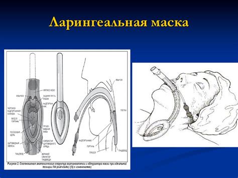 Анестезиология. Местная и регионарная анестезия - online presentation