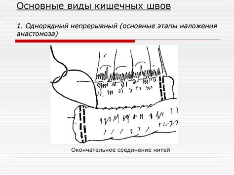 Хирургический шов - презентация онлайн