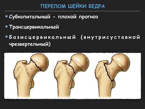 Визуализация тазобедренного сустава