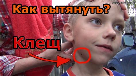 3 ПРОСТЫХ способа КАК вытащить КЛЕЩА - YouTube
