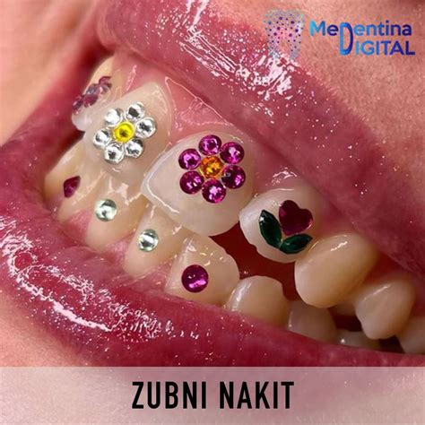 Zubni nakit – MEDENTINA DIGITAL