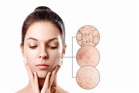 Skin Tags | ClairéDerma