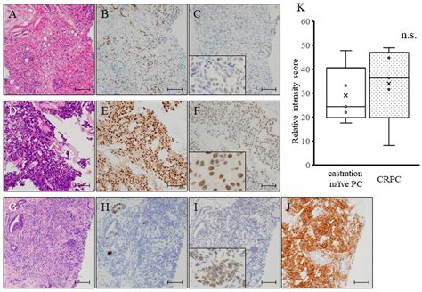 NCL1, A Highly Selective Lysine-Specific Demethylase 1 Inhibitor