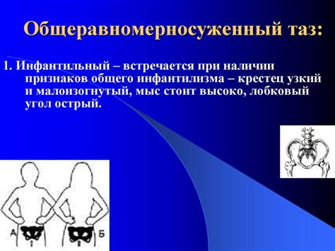 Узкий таз в современном акушерстве. (Лекция 18) - презентация онлайн