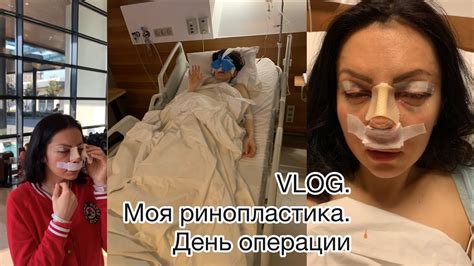 VLOG. Ринопластика. Блефаропластика. Моя Операция. Больница в Стамбуле ...