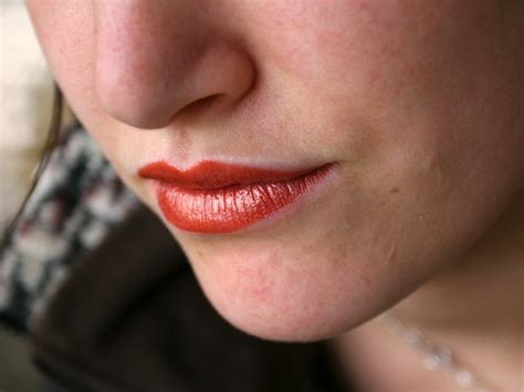 Hiv Lips Pictures | Lipstutorial.org