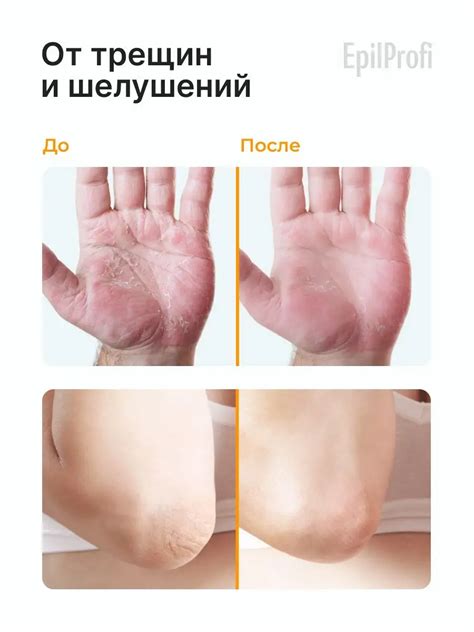 Крем воск от трещин для сухой кожи EpilProfi купить по цене 325 ₽ в ...