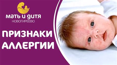 🥛 Диагностика аллергии на белок коровьего молока у детей. Аллергия на ...