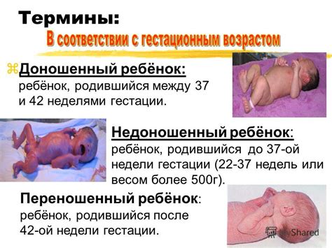 Презентация на тему: "1 Новорожденный ребенок. Особенности периода ...
