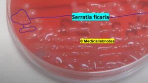 Serratia ficaria: Introduction, Morphology, Pathogenicity, Lab