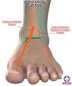 Ankle Anatomy | Sport Med School