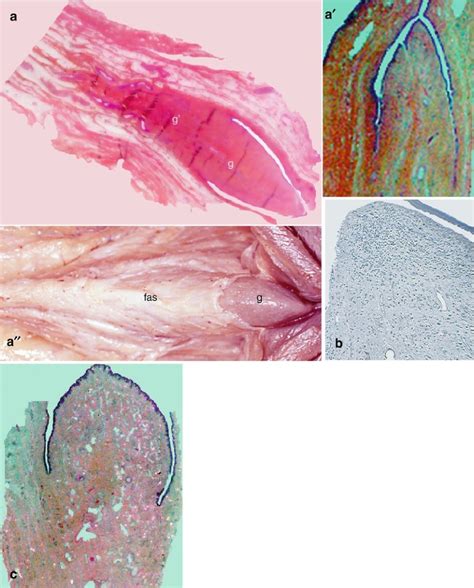 external morphology   clitoris springerlink