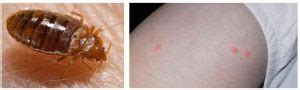 BEDWANTS | uitleg van de dermatoloog | actueel