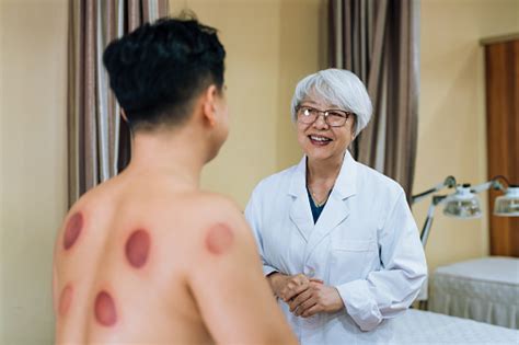 cupping treatment chinese senior female doctor checking red cupping