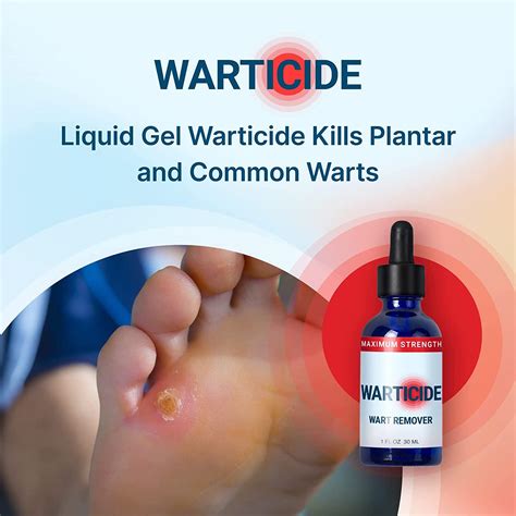 WARTICIDE Fast-Acting Wart Remover - Plantar and Genital Treatment ...