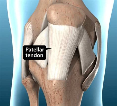 acl reconstruction  acl surgeon  tampa bay