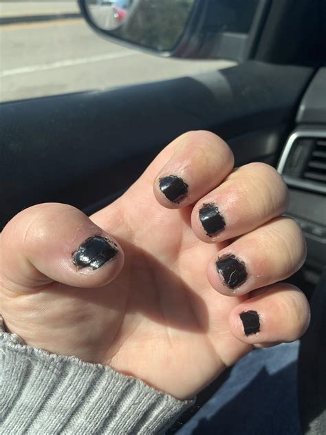 Short/bitten nails, can I get tips and dip powder done? Embarrassed by