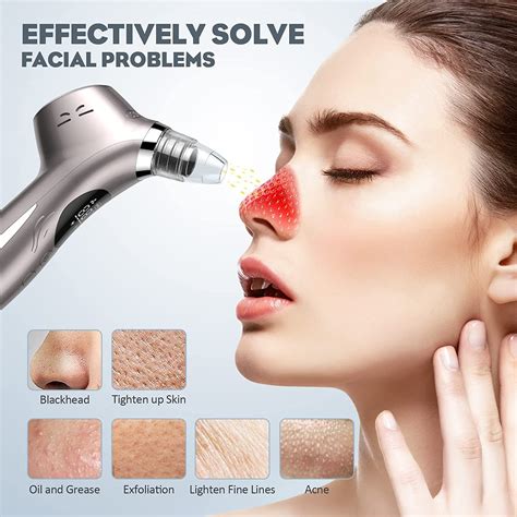 Looking For a Good Blackhead Remover? Try This "Secret" Vacuum & Enjoy