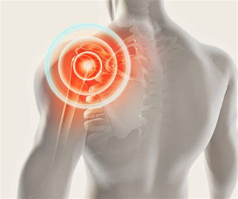 Labral Tear in the Shoulder