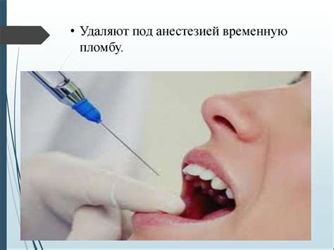 Лечебные и изолирующие прокладки - презентация онлайн