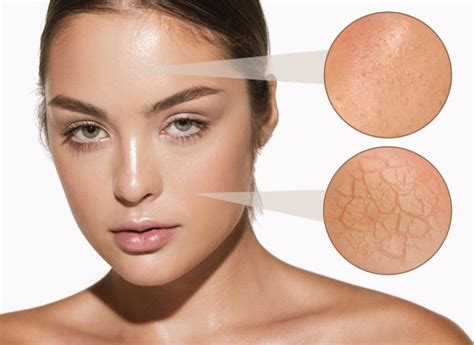 skin  dull  tired