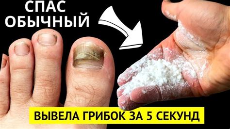 Грибок Ногтей НАВСЕГДА Исчезнет За 5 секунду, Поможет Этот Способ ...