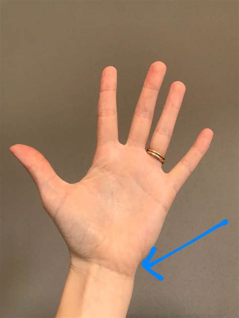 Right Hand Side Wrist Pain at Hillary Dodge blog