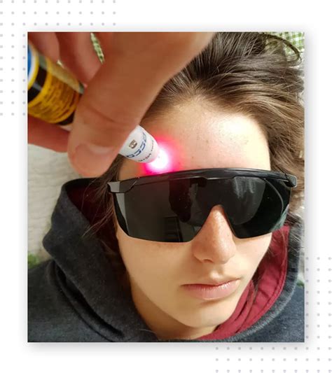 Laser Acupuntura - Energie Acupuntura