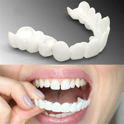 wttfc false teeth veneers top  bottom snap  veneers teeth snap
