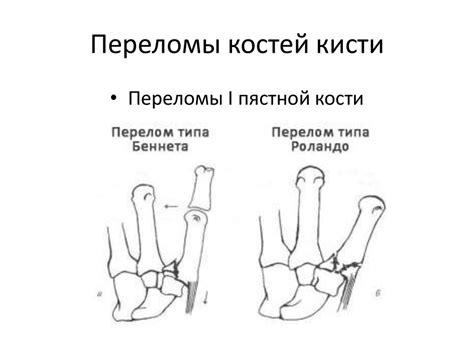 Повреждения кисти и предплечья - презентация онлайн