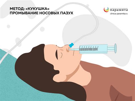 Острый гайморит - причины, симптомы, лечение