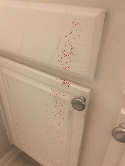 Boil on upper thigh issues can lead to serious infections 20