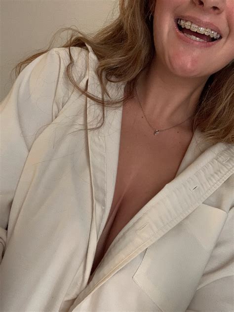 we’re obsessed, right? : r/Amature_Braces