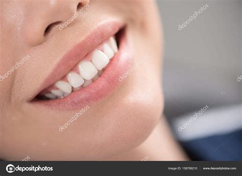 Cheerful smile with brilliant teeth — Stock Photo © iakovenko123 #158789210