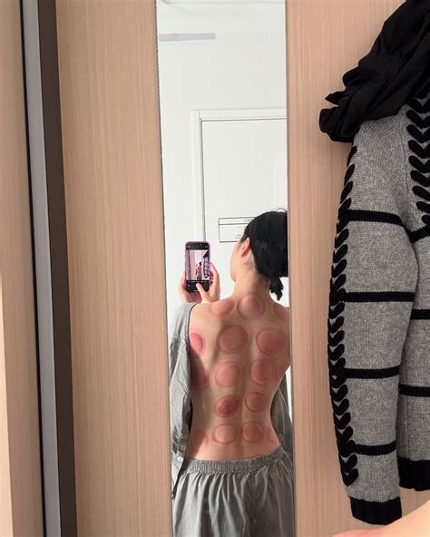 Sara Jane Ho | Cupping on the lower back and tailbone helps with cramps