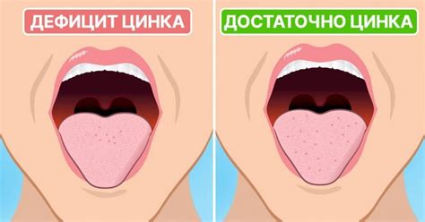 Неприятный привкус во рту: причины появления - Со Вкусом