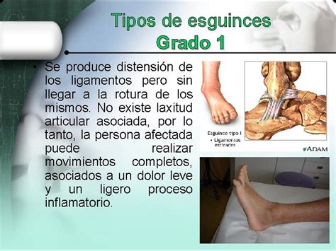 Fracturas lesiones osteoarticulares vendaje e inmovilizacin Tendones y