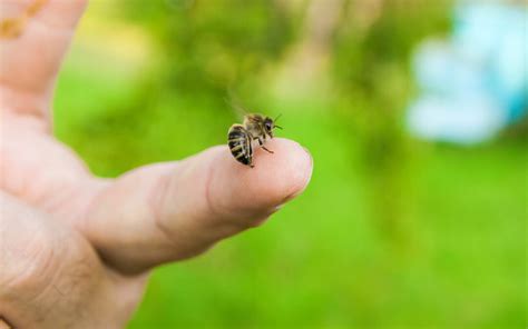 Bee Stinging In The Human Finger Of The Hand. | Northwest Exterminating