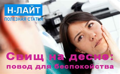 Свищ на десне – повод для беспокойства! | Н-Лайт