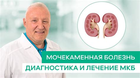 Мочекаменная болезнь, Диагностика и лечение. - YouTube