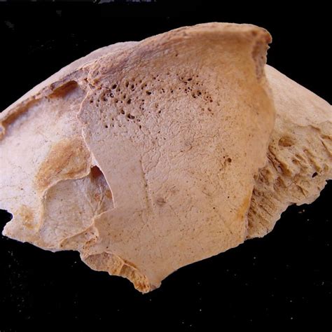 Detail of cribra orbitalia in an orbital fragment of individual T.138A3 ...