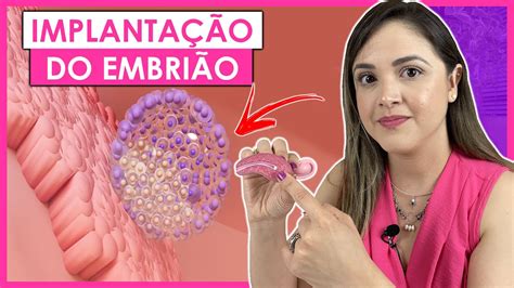 Quanto Tempo O Embrião Leva Para Se Fixar No Útero - SINTOMAS DA IMPLANTAÇÃO DO EMBRIÃO NO ÚTERO - YouTube