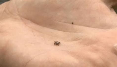 how to get rid of seed ticks on dogs
