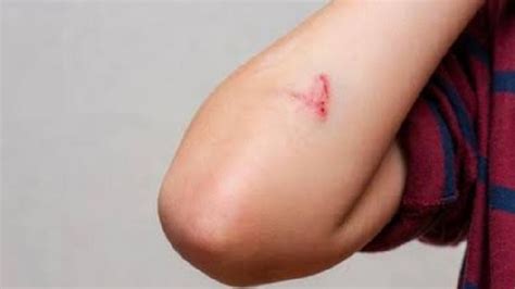 meningkatkan imunitas tubuh anak  keterampilan dasar mengobati