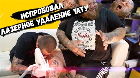 Лазер ПРОТИВ тату | лазерное удаление | как УДАЛИТЬ татуировку - YouTube