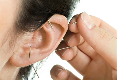 De Auriculoterapia 10