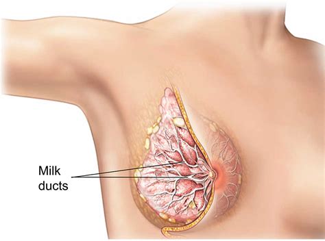 Infected Milk Duct