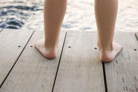 Flat Feet - Moreland Podiatry