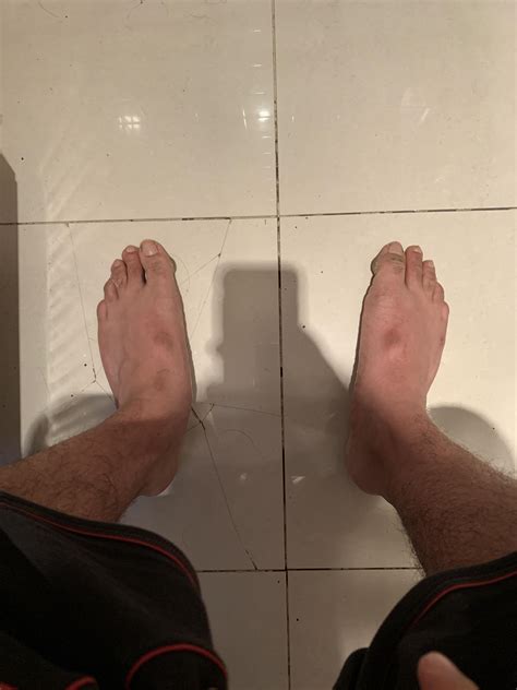 My feet hurt so much : r/flatfeet